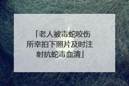 老人被毒蛇咬伤 所幸拍下照片及时注射抗蛇毒血清